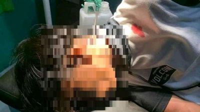 Kembali 5 Orang Pemilik Busur Panah Diamankan Polres Bima Kota