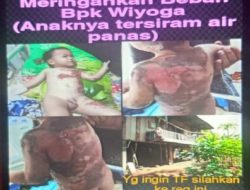 Bayi Umur 2 Tahun “HANAN LUTFI ELHAZIQ” Tersiram Air Panas Butuh Uluran Tangan